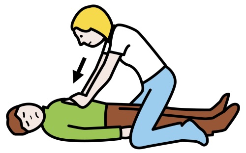 Técnicas de Reanimación Cardiopulmonar (RCP)